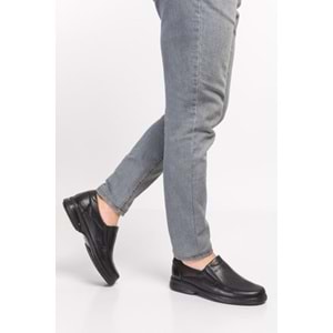 Dia 101 Tam Ortopedik İçi Dışı Hakiki Deri Diyabetik Erkek Şeker Ayakkabısı - 101 - Siyah - 39